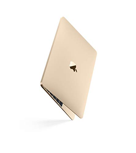 Retina