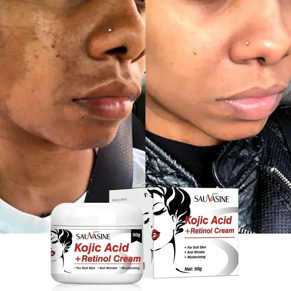 « Crème visage: acide kojique et rétinol » – Test et Avis